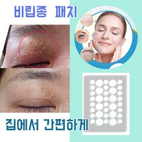 눈가 지방 패치, 142개