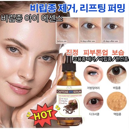 비립종 아이 에센스 반점제거에센스 숨아이크림 천연 원두 녹차 눈가 개선 코용종 제거 비립종/한선종/지방덩어리