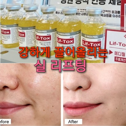 실리프팅 3개국특허 톡스 앰플 /주름골 콜라겐 안티에이징