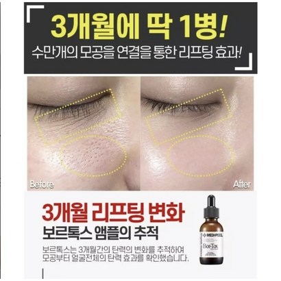 보르톡스 깊은주름 앰플/줄기세포보르피린 환상적인조합/보르피린후기/보르피린성분