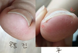 갤러리 이미지