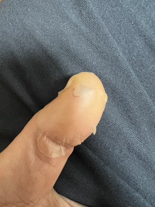 갤러리 이미지