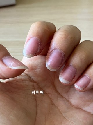 갤러리 이미지