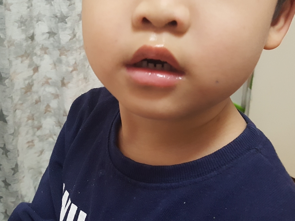 루카스 포포 연고 리뷰 후기