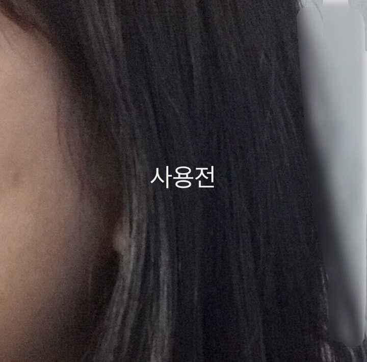 트러블 피부관리 피부 상처 뾰루지 건조함 좋은 피부 만들기 뉴 리스팟