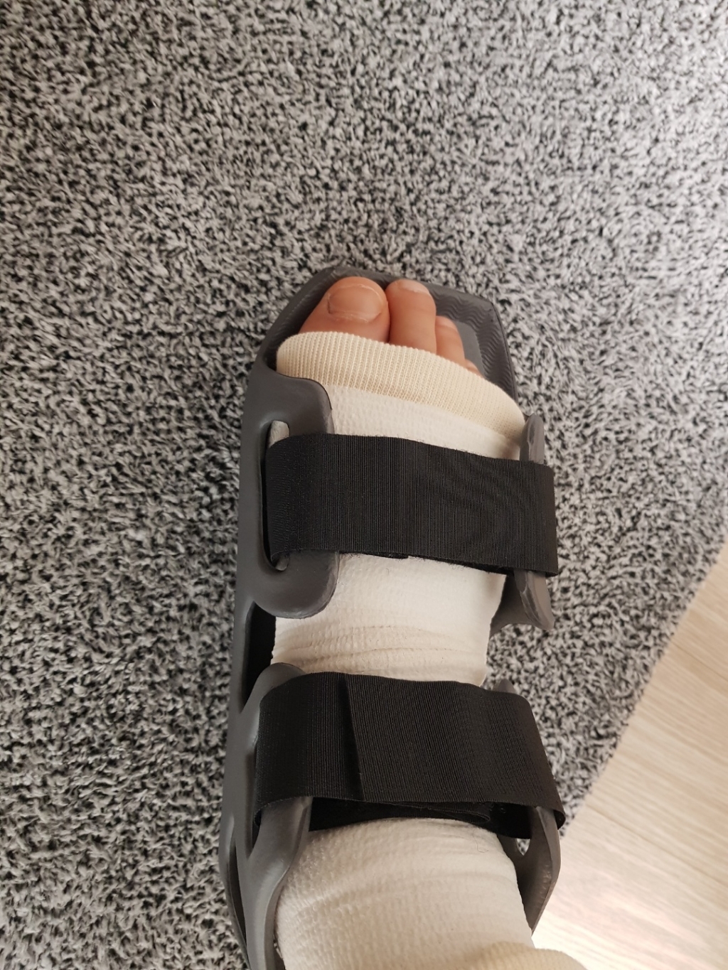오웰 깁스신발 깁스방수커버 다리커버 <선착순 >