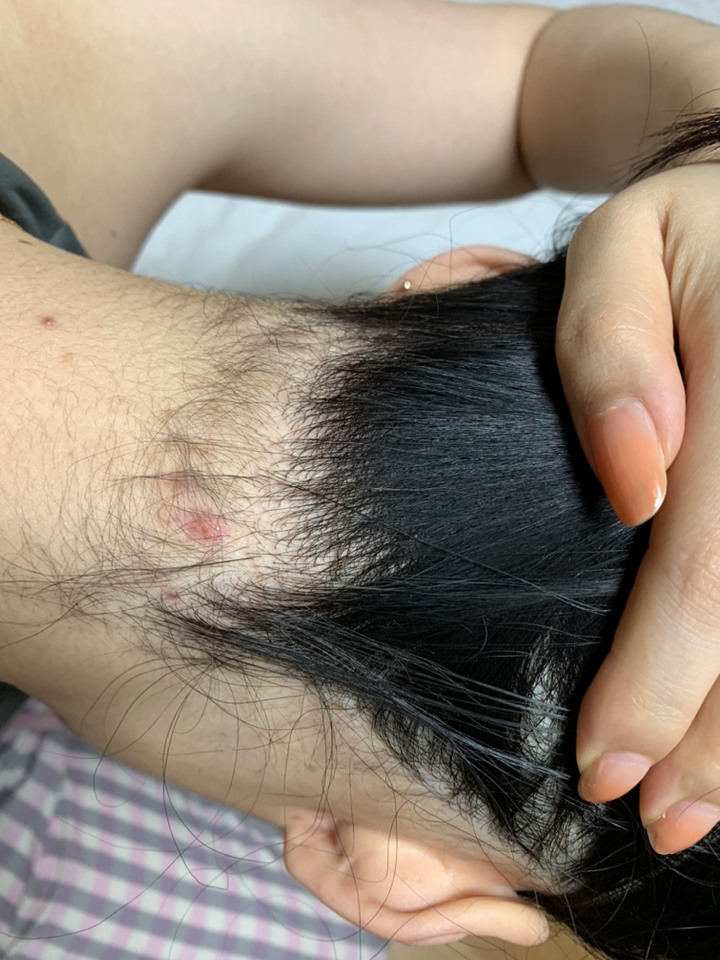 A 댄트 쿨링 멘톨 탄산수 샴푸