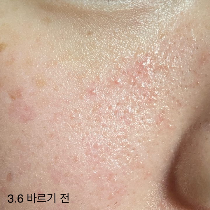 네이처리퍼블릭 그린더마 마일드 시카 세럼 with 카밍 젤 크림 기획세트