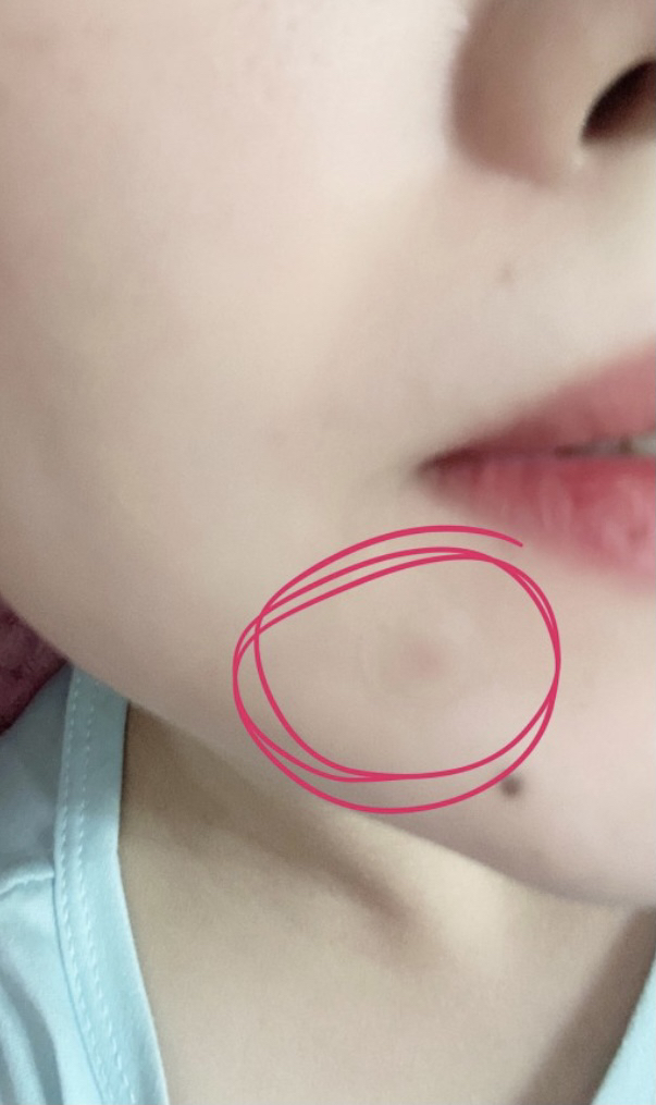 테라클리어 스팟패치 102매입 리뷰후기
