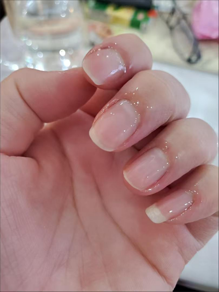 손톱재생 케어 손톱영양제 강화제 문제성 손톱 보조제 큐티클오일 윤기있는 건강한 손톱만들기 손톱 영양제 오일펜 짧은 손톱 고민 해결, 1개, 10ml
