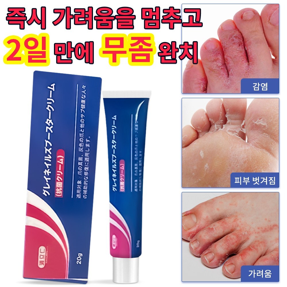 [당일배송] 무좀약 발톱무좀 발톱무좀약치료제 무좀약바르지오 라미실원스무좀약 발바닥 발가락 가려움 완화 연고 일본 발 연고 발냄새 ...