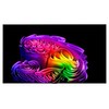 LG전자 4K UHD OLED evo AI TV, OLED77G6KNA, 방문설치, 벽밀착 벽걸이형, 194cm(77인치)