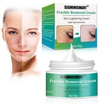 미백 크림 미백 크림 주근깨 크림 검버섯 크림 피부 미백 크림 검버섯 주근깨 제거제 크림 스킨케어