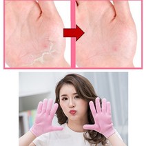 클라이밍 굳은살제거 손톱 가시래기 손톱에이슬 손등각질 거친손관리 핸드팩 손바닥 껍질