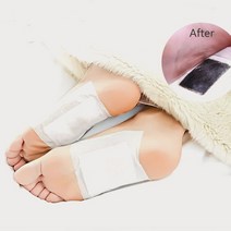 수액시트 50매 대용량 풋패치 발바닥통증 목초수액시트