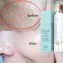 스킨케어 바디케어 15ml auquest 살리실산 여드름 치료 페이스 크림 안티 여드름 젤 수축 모공 모이스춰 라이징 세럼