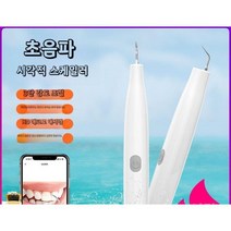 초음파치아스케일링 치석제거, B