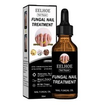 발톱 네일 리페어 조갑사균증 에센스 진균 30ml 50ml, 1개