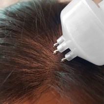 스칼프로지 미녹시딜 투입가능 헤어토닉 두피 도포기, 흰색