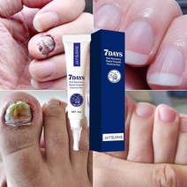 BT 발톱무좀치료 무좀약 네일 리페어 에센스 손발톱 강화 영양제, 1개, 7ml
