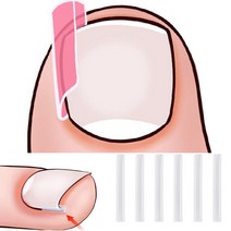 말린발톱 보호 지지대 내향성발톱 발톱와이어 스틱 발톱테이프 파고드는 발톱 테이핑 내향형발톱, C타입