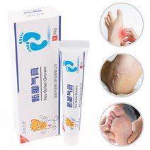 발톱 무좀 레이저 운동 선수를위한 1pcs 20g 항진균 크림 Foot Jock 가려움증 피부 균류 및 ringworm Corn Remov