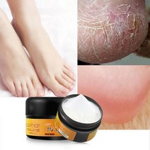 무좀 치료 기기 지료제 무좀 치료 기기 지료제 1box 천연 마유 발 크림 케어 각기 크림 운동 선수 발