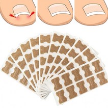 내향성 자가치료 간편 발톱 밴드 테이프 KK587, 10P(1장)