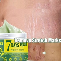 스트레치 마크 제거 크림 효과적인 비만 제거 임신 바디 마크 산후 흉터 여드름 퍼밍 바디 스킨 리페어 크림, 50g, 1개