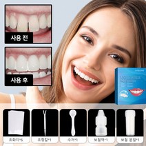 1+1치아미백패치 보철 접착제 세트 인텐시브 치아미백겔 실용적/안전/쉬운 조작, 보철 접착제 세트*6, 1set