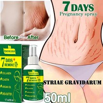 스킨케어 바디케어 2022 스트레치 마크 스프레이 수리 제거 여드름 흉터 스트레치 마크 크림 지방 흉터 줄무늬 치료 줄무늬, 30ml