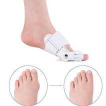 생안발발톱꼬임교정패치 족저근막염실내화 평발슬리퍼 자세교정 bunion splint 엄지 발 통증 완화 외반 외반 정형 외과 용품 페디큐어 발 관리