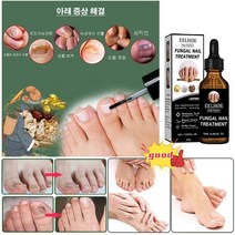 30g 손톱무좀케어리페어발톱무좀약조갑사상균증 치료제, 30ml *20개