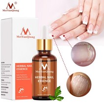 여름 손톱 nail fungal treatment feet care 에센스 nail