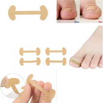 내성발톱밴드 내성발톱케어밴드 내성발톱 보호밴드, 1개