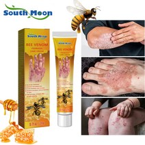 피부가려움증 연고 습진 크림 모낭염 두피 건선연고 지루성피부염 치료, 20ml, 2개