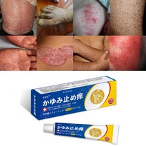 1+1 피부가려움증 두드러기 피부건선 발진 모낭염 완화 가려움증 지루성피부염 치료 연고, 15g*2