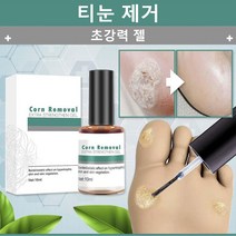 국내출하(당일발송) 1 1 발가락 티눈 치료 편평사마귀 발바닥 티눈 제거 10ML, 10ml × 1 1