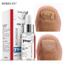 국내출하(당일발송) iBeaLee 발톱무좀 치료 발톱무좀 연고 발무좀연고, 1개, 20ml