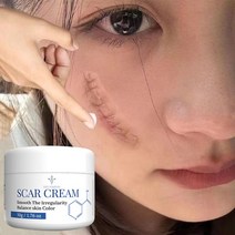 흉터 제거 연고 흉터 관리 흉터재생연고 상처흉터 수술흉터, 2개, 50g