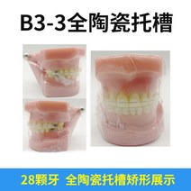 치아모형 교정 모델 금속 세라믹 표준 브래킷 모델 금형 수정 임플란트 통신 교육, 풀 세라믹 브라켓 b3-3