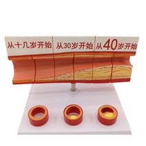 인체모형 혈관모형 혈중중성지방 병원 교육 의료 실습 모델 홈쇼핑 소품, C타입