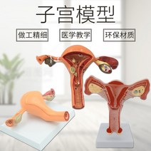 모형 난소 학습 피규어 교구 질 자궁 산부인과 인체, 병리 자궁