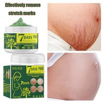 30g 임신 스트레치 마크 리페어 크림 산후 비만 피부 스트레치 흉터 바디 마크 리무버 부드러운 스킨 케어