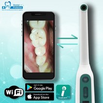 구강카메라 덴탈 카메라 구강 관리 셀프 치석 제거 무선 와이파이 hd usb 내 내시경 장치 led 라이트 실시간 비디오 검사 치아 미백 256, DC-W