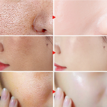 Pore Shrinking Serum Skin Elasticity Delicate Repair Essence Clean Blackheads Acne Moisturizing Smoo, 01 30ml