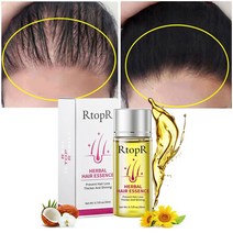 탈모에센스 샴푸 허브 모발 성장 오일 탈모 방지 제품 대머리 두피 치료 빠르게 성장하는 두꺼운 에센셜 헤어 케어