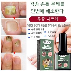 발무좀치료제