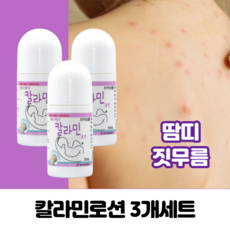 칼라민볼