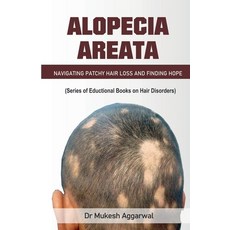 (영문도서) Alopecia Areata Paperback, Notion Press, English, 9798892330633